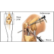 Arthroscopy